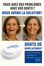 Charger l'image dans la galerie, Prothèse Dentaire Facile à Poser et Réutilisable : Un Nouveau Sourire en 30s 😁
